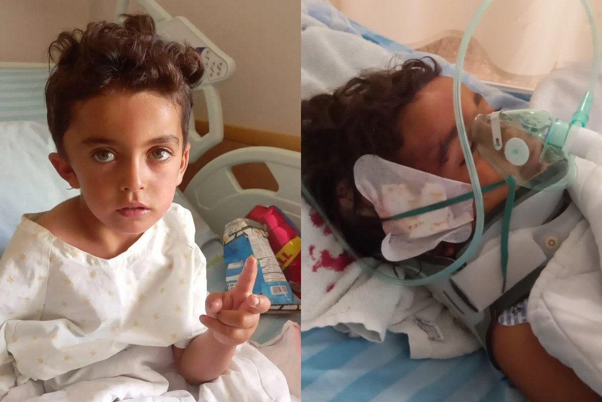 Pemukim Melempar Kepala Anak Palestina Berusia 4 Tahun dengan Batu