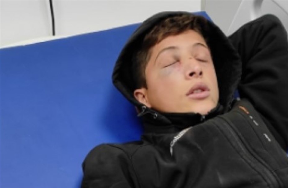 Pasukan Pendudukan Menyerang Seorang Anak di Ramallah