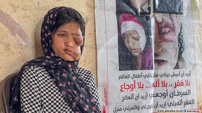 Israel Kembali Tak Beri Izin Warga Gaza Berobat Keluar