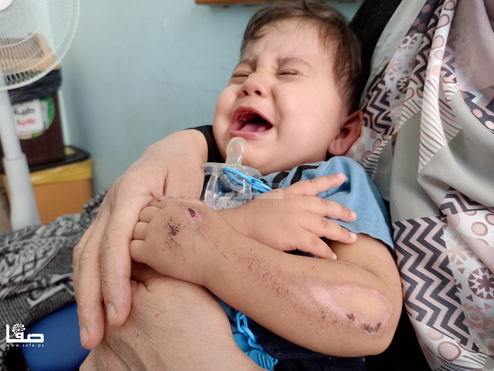 Israel Lukai Ibu dan Bayi 15 Bulan selama Agresi Gaza