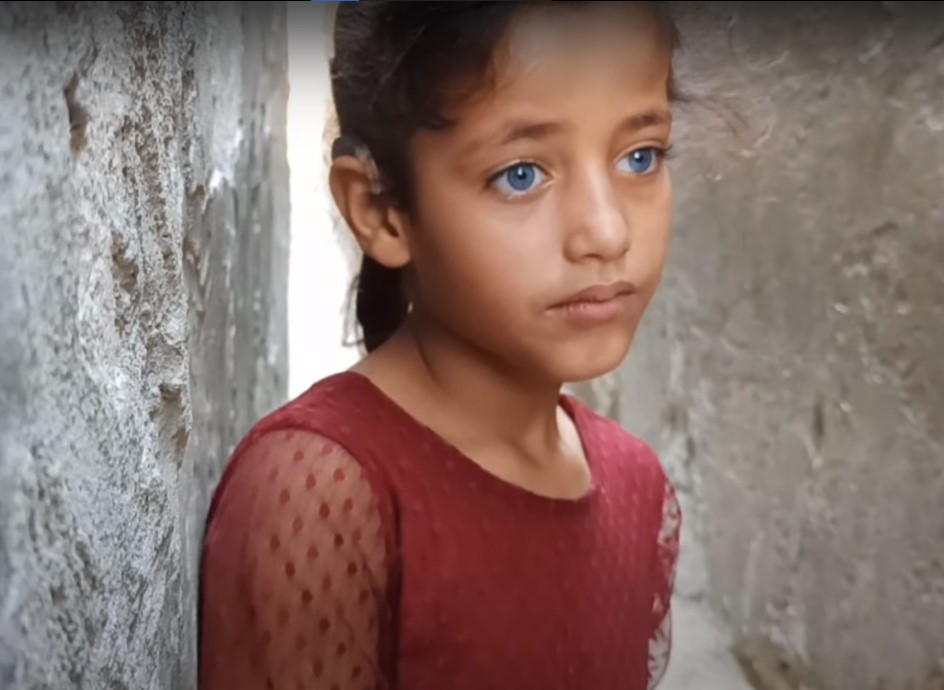 Bahagianya, Judy Berhasil Jalani Operasi Implan Koklea