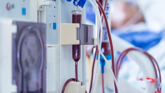 Ratusan Balita di Indonesia Terjangkit Gagal Ginjal Akut Misterius, Begini Penyebabnya