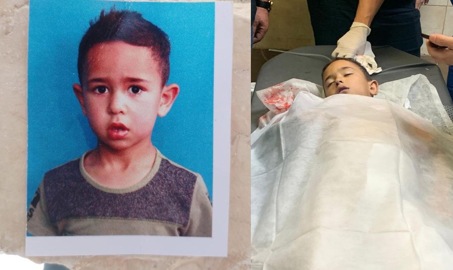 Rayyan ketika masih hidup (kiri) dan usai wafat di RS (kanan)