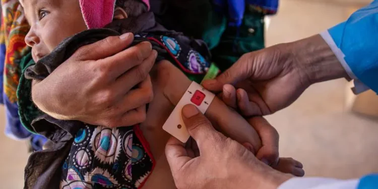 Kasus Malnutrisi Meningkat 50% di Afghanistan