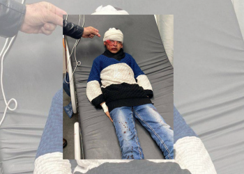 Pasukan Israel Serang dan Pukuli 3 Bocah di Hebron dan Bethlehem