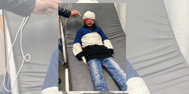 Pasukan Israel Serang dan Pukuli 3 Bocah di Hebron dan Bethlehem