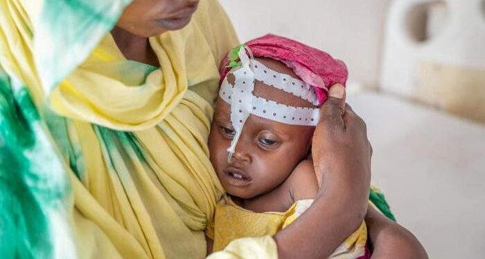 Lebih dari 20 Juta Anak Afrika Kelaparan Akibat Perubahan Iklim