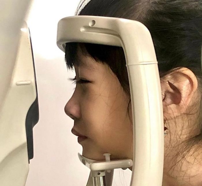 Pascapandemi Covid-19 Kasus Myopia Booming Terjadi pada Anak, Apa Itu Myopia Booming?