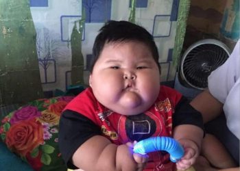 Viral Bayi dengan Berat 26 Kilogram! Dokter Peringatkan Ini