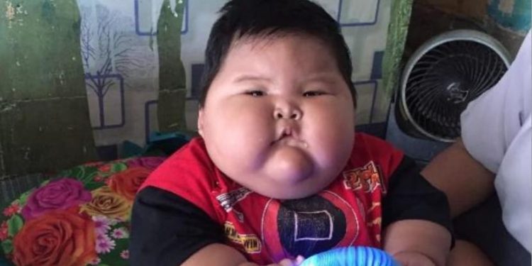 Viral Bayi dengan Berat 26 Kilogram! Dokter Peringatkan Ini