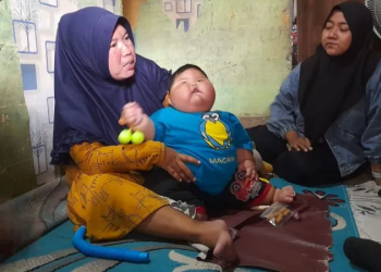 Jangan Dianggap Lucu, Ini Bahaya Anak Obesitas!