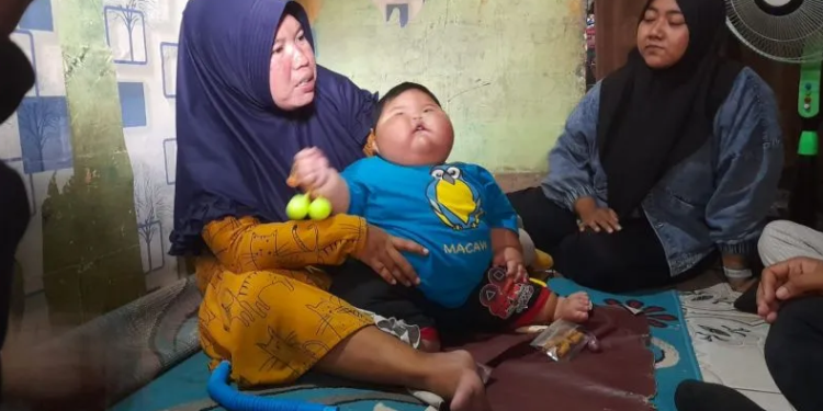 Jangan Dianggap Lucu, Ini Bahaya Anak Obesitas!