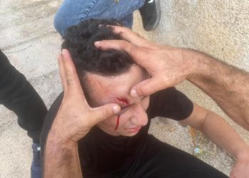 Israel Serang Desa Kafr Qaddum, Lukai Dua warga Palestina, termasuk Seorang Anak