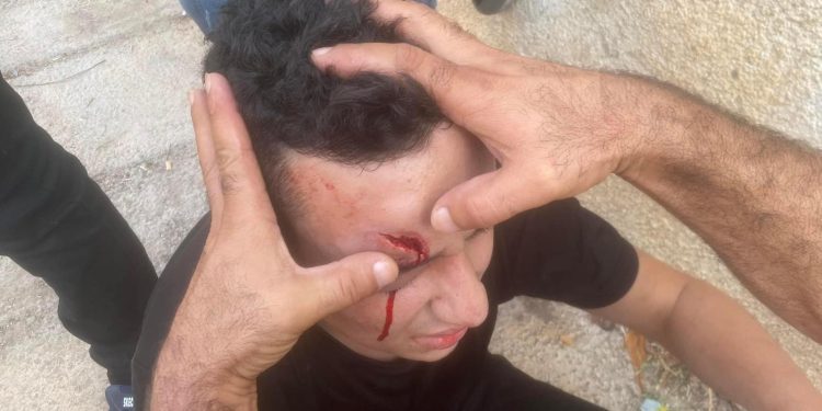 Israel Serang Desa Kafr Qaddum, Lukai Dua warga Palestina, termasuk Seorang Anak