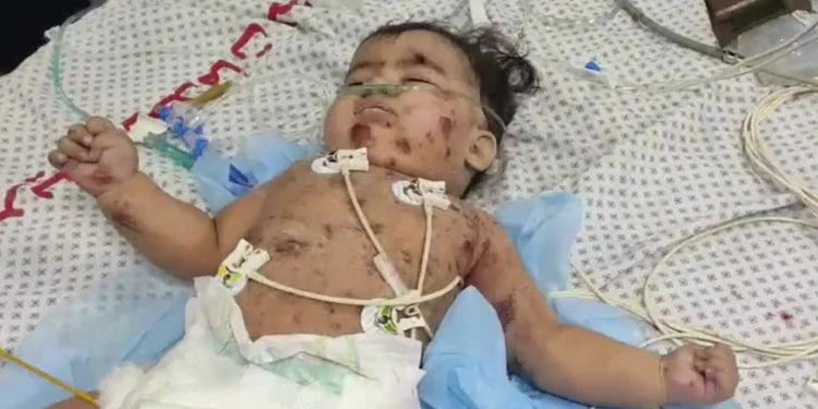 Israel Mengebom ICU untuk Bayi Baru Lahir di RS Kamal Adwan, Satu Bayi Terbunuh