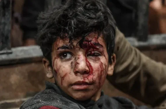 Menurut Pakar, Orang Palestina Hidup dalam Trauma Konstan