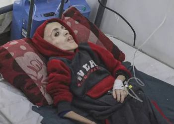 Gaza sedang Menyaksikan Tingkat Malnutrisi Terburuk di Seluruh Dunia