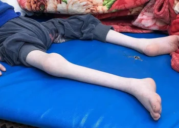 UNICEF Memperingatkan Kematian 23 Anak di Gaza Akibat Kekurangan Gizi Hanyalah 'Puncak Gunung Es'