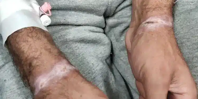 Israel akan Memindahkan Tawanan dari Gaza ke Pusat Penahanan Militer di Tepi Barat