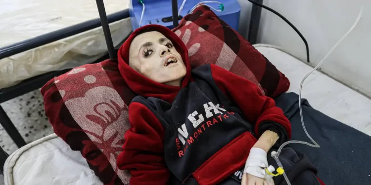 Rumah Sakit Gaza Mencatat Pertambahan 50 Anak Palestina Kekurangan Gizi Hanya dalam Sepekan