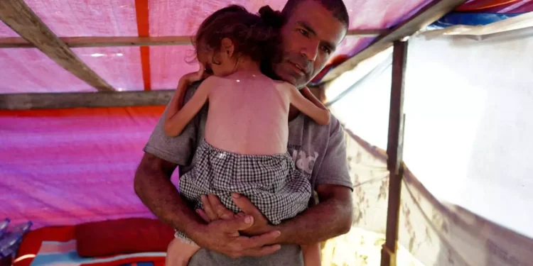 Seorang anak Palestina Meninggal karena Kekurangan Gizi saat Krisis Kelaparan Melanda