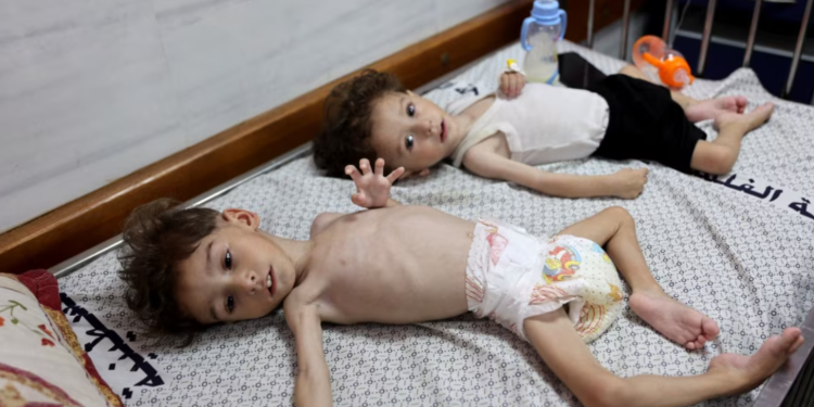 Pakar PBB: Israel Melakukan Kampanye Kelaparan yang Disengaja di Gaza