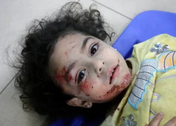 Kelaparan dan Hilangnya Masa Kanak-kanak di Gaza adalah Aib Kemanusiaan pada Abad ke-21