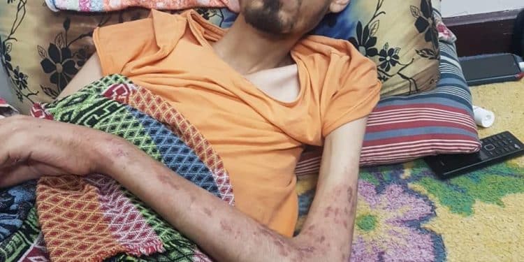 12.000 Orang Terluka dan 14.000 Pasien Butuh Pengobatan di Luar Gaza