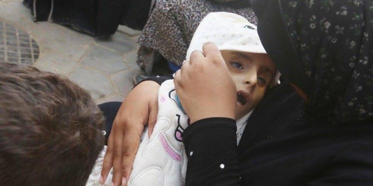 Anak Berumur 4 tahun Meninggal Akibat Malnutrisi di Gaza