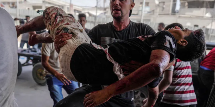 Update Hari ke-307: Korban Terbakar saat Tenda-Tenda dibom di Khan Younis