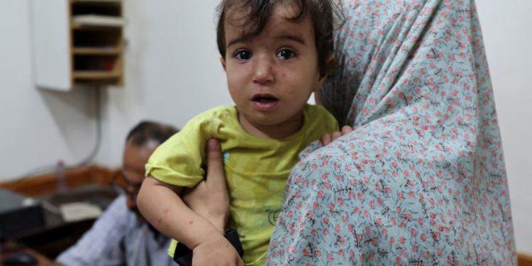 500.000 Anak Palestina Butuh Vaksinasi Polio, Sekjen PBB Minta Jaminan Gencatan Senjata Kemanusiaan di Gaza