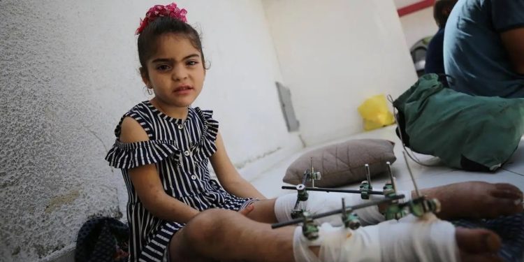 Kementerian Kesehatan dan ICRC Mulai Mendokumentasikan Kasus-kasus Cacat dan Amputasi Akibat Agresi di Gaza