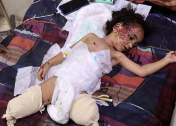 WHO: Puluhan Warga Gaza dengan Cedera Parah Akan Membutuhkan Rehabilitasi Bertahun-Tahun