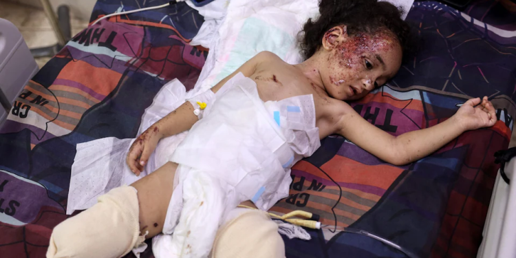 WHO: Puluhan Warga Gaza dengan Cedera Parah Akan Membutuhkan Rehabilitasi Bertahun-Tahun