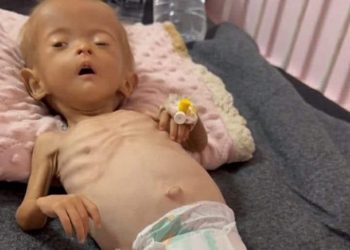 Seorang Gadis Kecil Palestina Menghembuskan Nafas Terakhirnya karena Kekurangan Gizi di Gaza