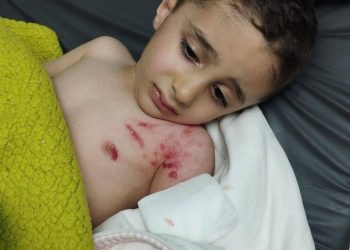 Anak Palestina Usia 3 Tahun Diserang Anjing Tentara Israel