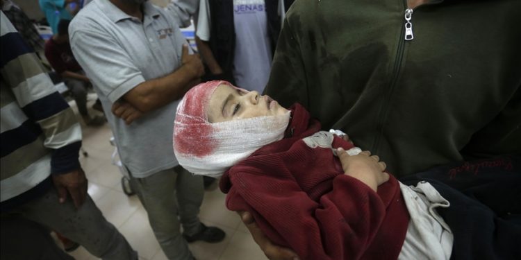 Dokter Bedah AS Menceritakan Pengalaman Mengerikan di Gaza