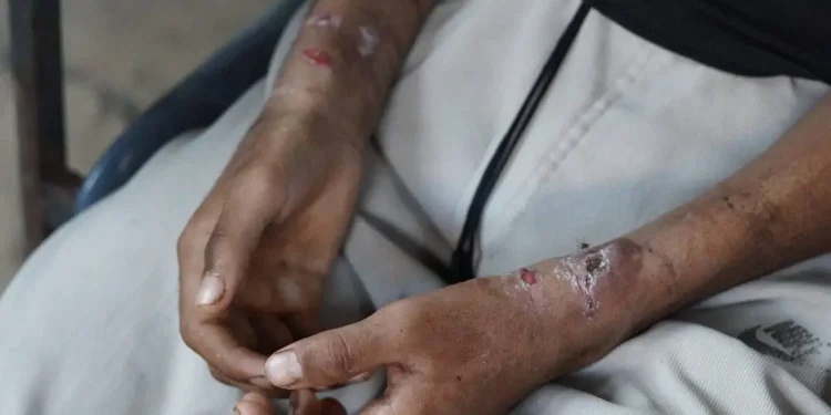 Kematian Warga Palestina saat Interogasi Shin Bet Picu Kekhawatiran soal Penyiksaan