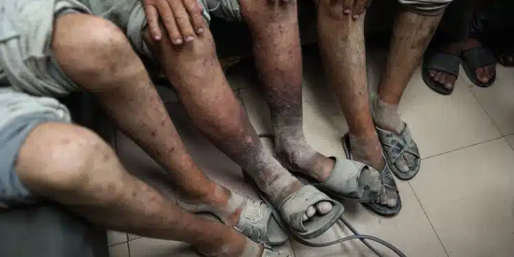 Serikat Pekerja Arab: Israel Menyiksa Pekerja Palestina Hingga Meninggal