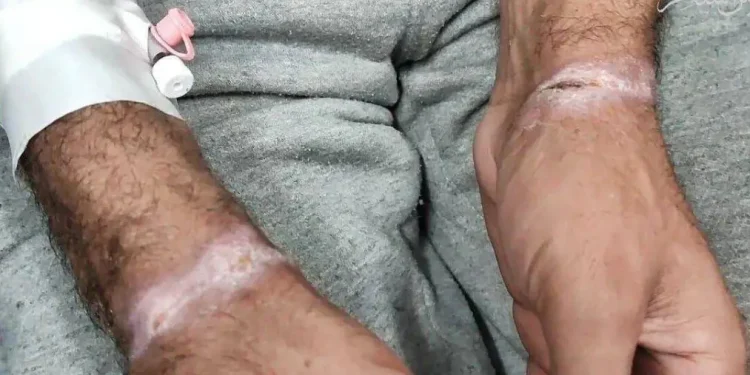 Tawanan Palestina di Penjara Naqab Menghadapi Kondisi Berat dan Kelalaian Medis