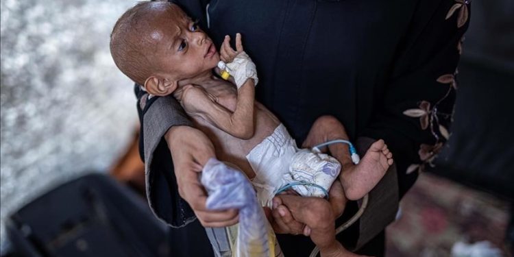 Gaza Terancam Kelaparan Total: Bayi dan Anak-Anak Menjadi Korban Utama