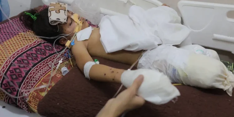 4.500 Penduduk Gaza Diamputasi akibat Genosida Israel: Mimpi yang Terkubur dan Luka yang Tak Kunjung Sembuh