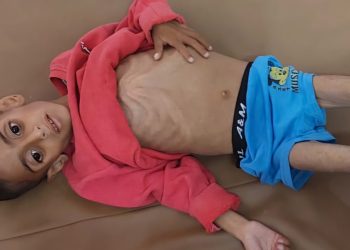 Anak-Anak Gaza di Ambang Malnutrisi Akut: Pengepungan Israel Memicu Bencana Kemanusiaan