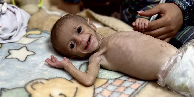 Kondisi Anak-Anak di Gaza Kian Memburuk: Di Ambang Kelaparan dan Genosida