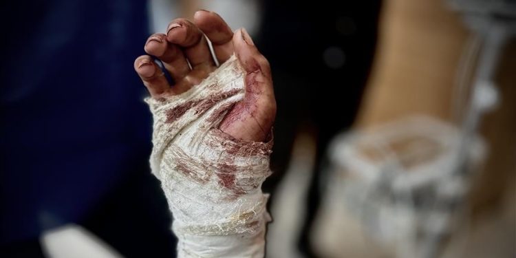 Anak-anak Palestina Menderita Akibat Pemukulan dan Kelaparan di Penjara-Penjara Israel