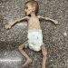 Gaza, Tempat Paling Lapar di Dunia: Anak-anak Meninggal karena Kelaparan, Sistem Kesehatan Runtuh