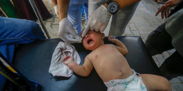 Anak-Anak Gaza Jalani Operasi Tanpa Bius di Tengah Krisis Kemanusiaan