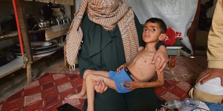 FAO dan WFP: Seluruh Penduduk Gaza Terancam Kelaparan Akut