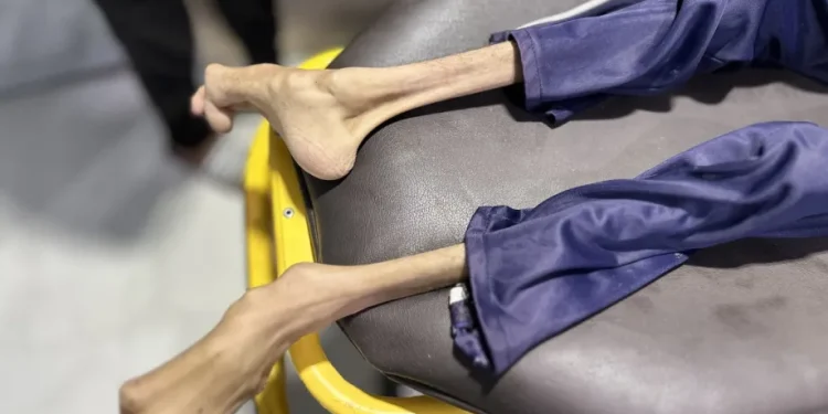 Warga Palestina Kembali Meninggal akibat Kelaparan di Tengah Blokade Israel