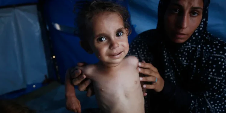 WHO: Krisis Gizi Anak-Anak di Gaza Makin Parah, Situasi Kemanusiaan Darurat Kelaparan